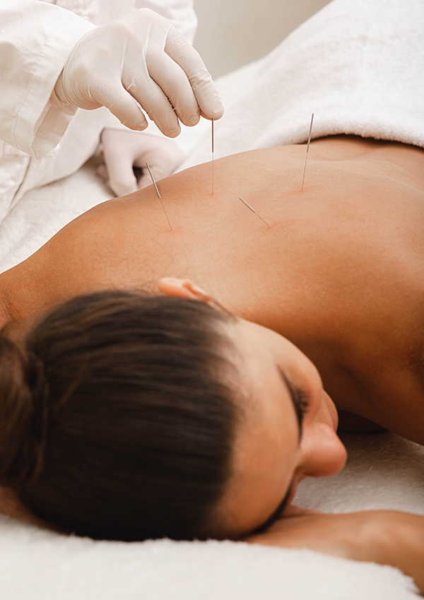 woman receiving acupuncture treatment from a medical practitioner
